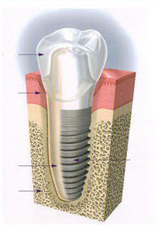 low cost Dental Surgery India