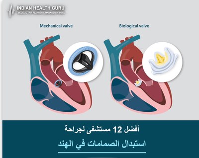 أفضل 12 مستشفى لجراحة استبدال الصمامات في الهند (دليل 2026-2027)