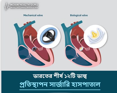 ভারতের শীর্ষ ১২টি ভাল্ব প্রতিস্থাপন সার্জারি হাসপাতাল (2026-2027 গাইড)