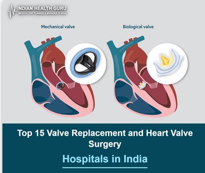 Top 15 Valve Replacement and Heart Valve Surgery Hospitals in India (2026-2027 Guide)