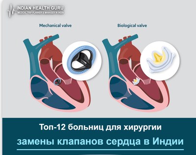 Топ-12 больниц для хирургии замены клапанов сердца в Индии (Руководство 2026-2027)