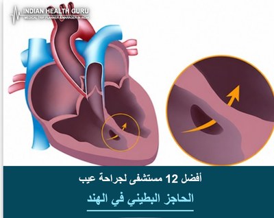 أفضل 12 مستشفى لجراحة عيب الحاجز البطيني في الهند (دليل 2026-2027)