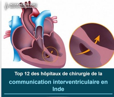 Top 12 des hôpitaux de chirurgie de la communication interventriculaire en Inde (Guide 2026-2027)