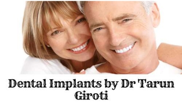 explore-all-types-of-dental-implants-by-dr-tarun-giroti-1-638