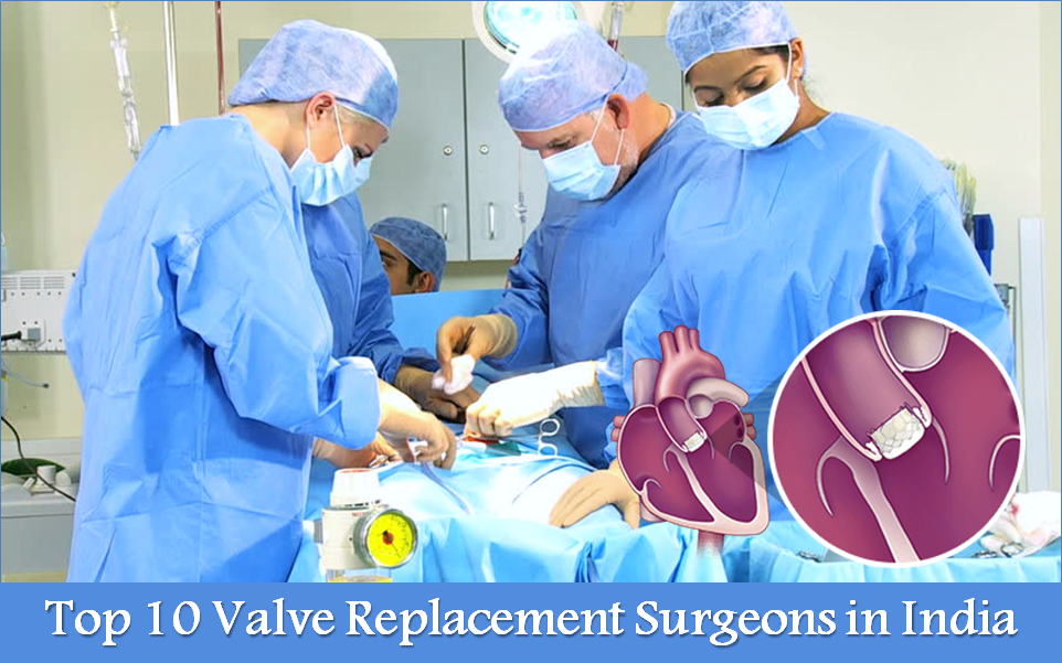 Top 10 Valve Replacement Surgeons in India