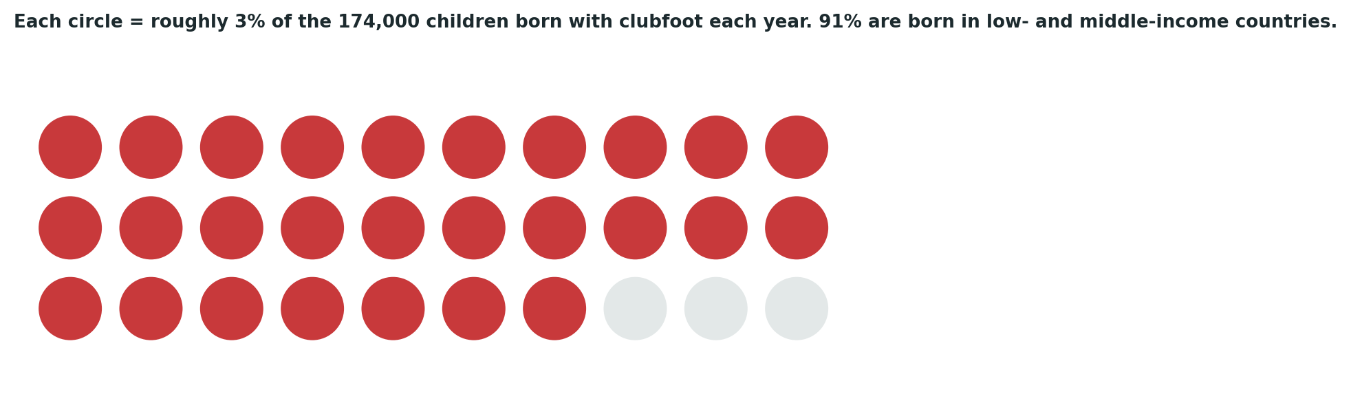 Chart: Clubfoot is not a rare condition globally — it is heavily concentrated in the countries least equipped to treat it with specialist care