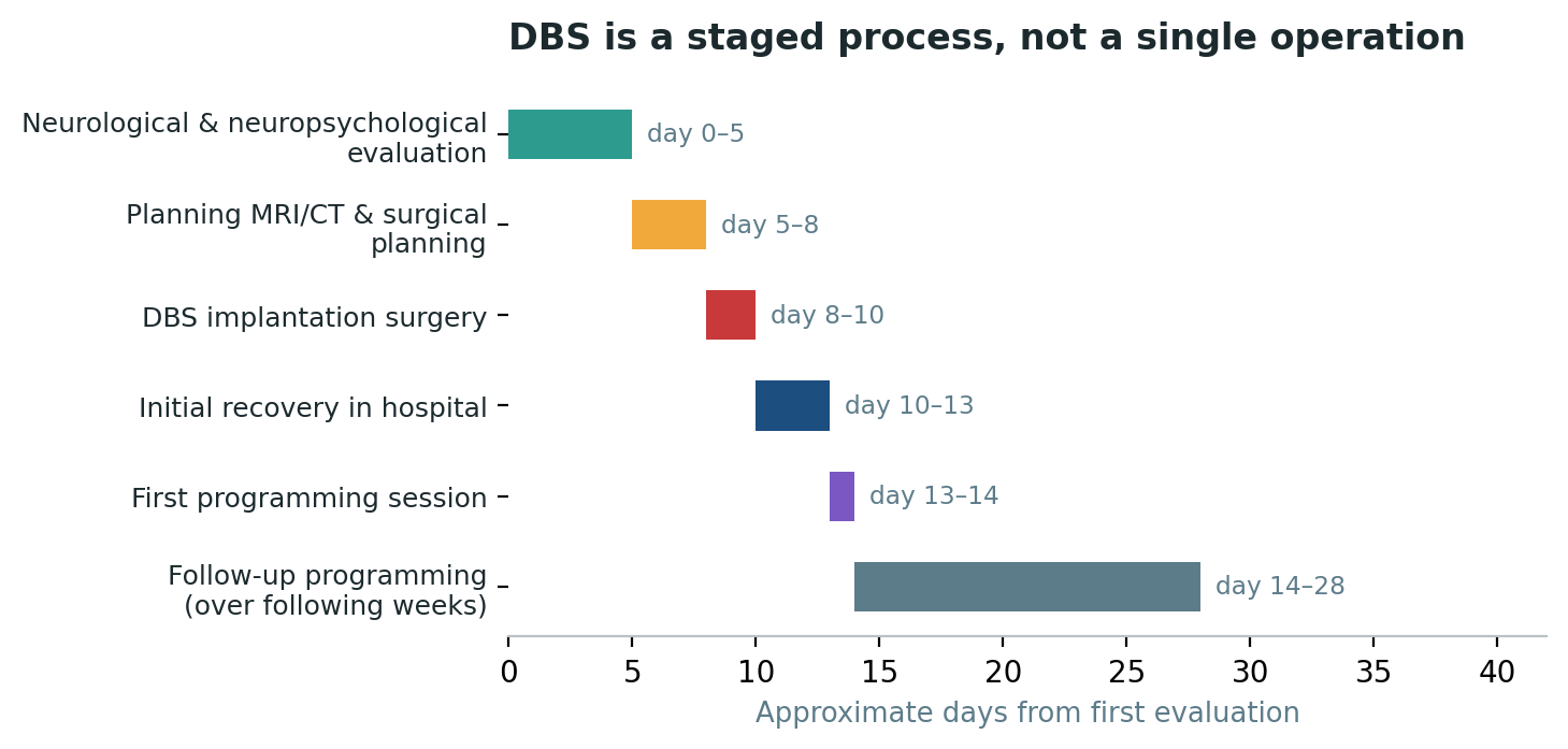 Chart: DBS is best understood as a staged process spanning weeks, not a single surgical event