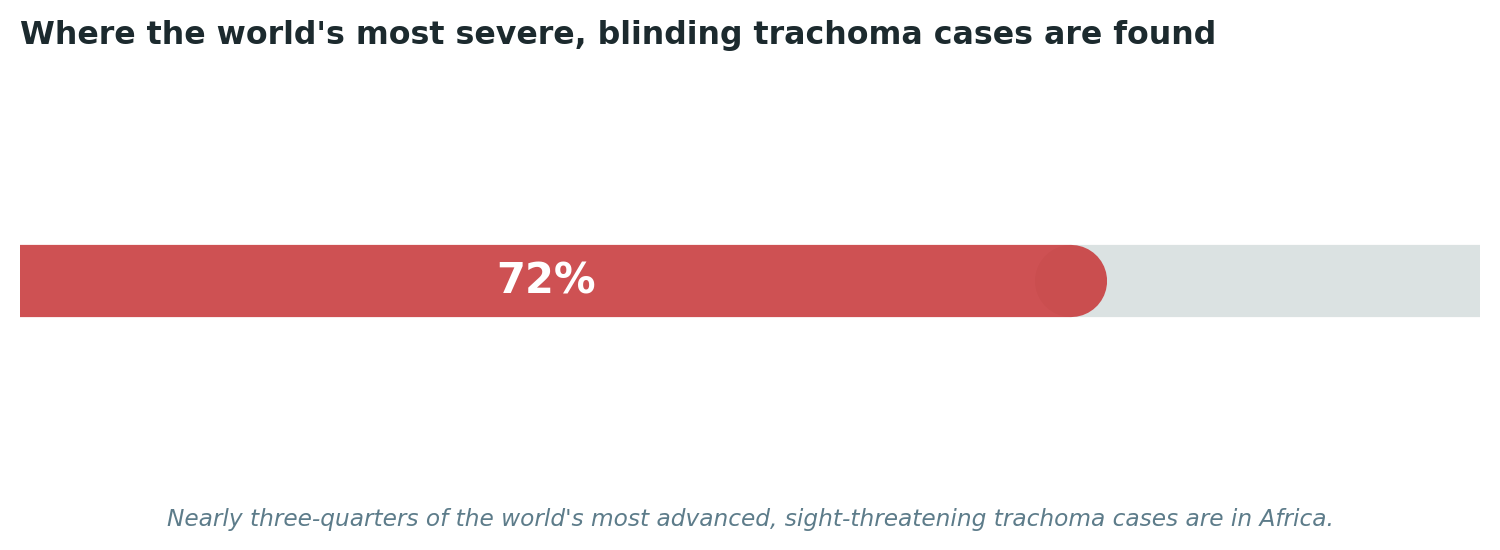 Chart: A disease whose most damaging consequences are concentrated overwhelmingly in this specific region