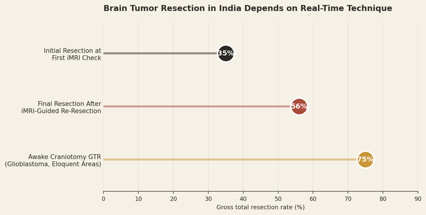 Brain tumor resection in India depends on real-time technique. Initial resection at first iMRI check 35%, final resection after iMRI-guided re-resection 56%, awake craniotomy GTR (glioblastoma, eloquent areas) 75%.