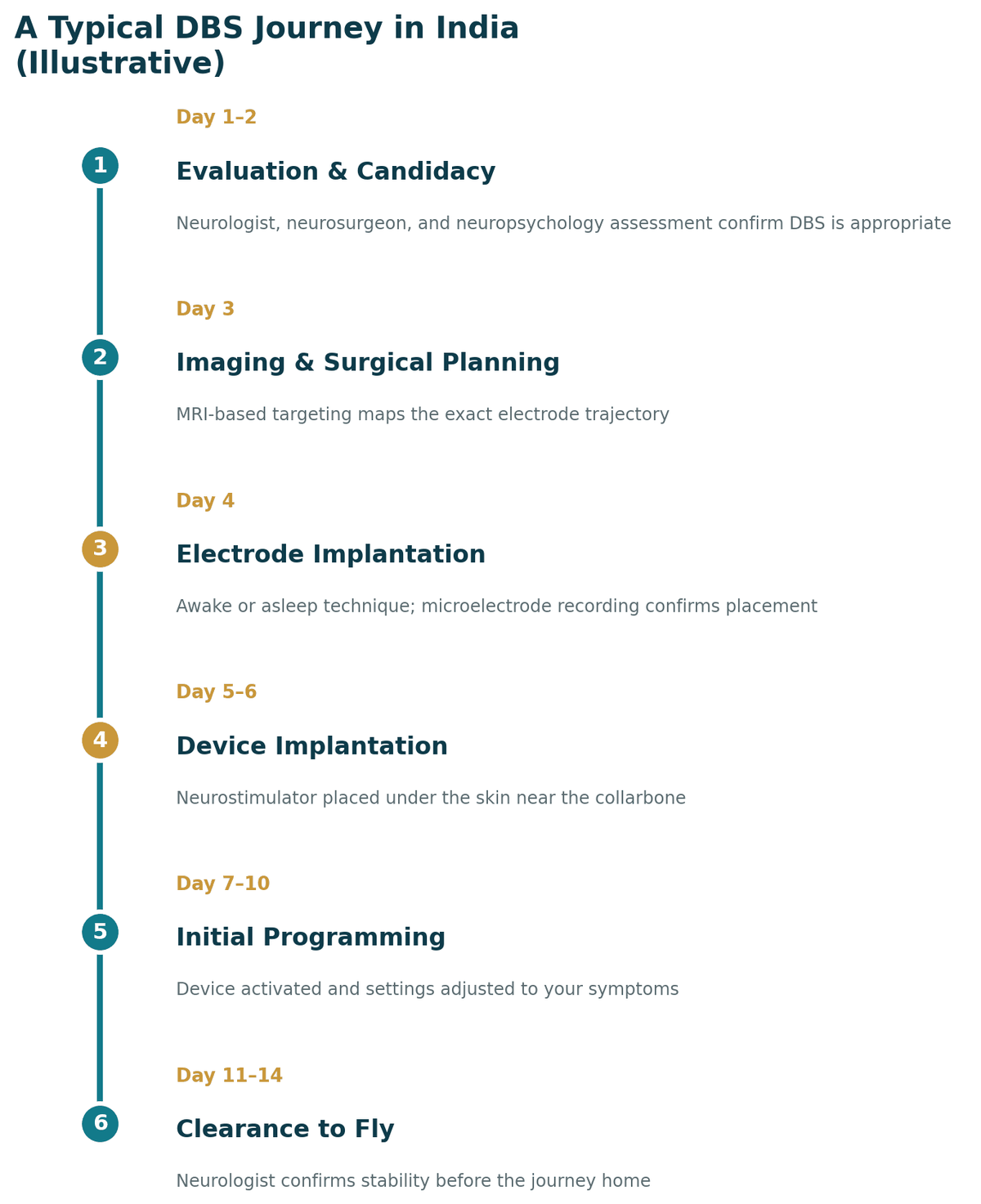 A typical DBS journey in India, illustrative: days 1 to 2 evaluation and candidacy with neurology, neurosurgery and neuropsychology assessment; day 3 imaging and surgical planning; day 4 electrode implantation; days 5 to 6 device implantation; days 7 to 10 initial programming; days 11 to 14 clearance to fly.