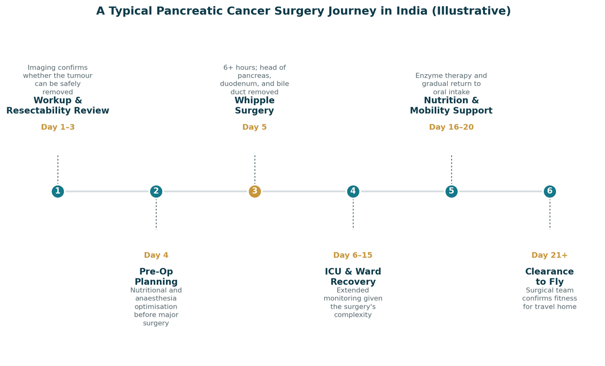 A typical pancreatic cancer surgery journey in India, illustrative: days 1 to 3 imaging and resectability review; day 4 pre-operative planning; day 5 Whipple surgery; days 6 to 15 ICU and ward recovery; days 16 to 20 nutrition and mobility support; from day 21 clearance to fly.