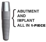 Immediate Function procedure with Nobel Biocare implants