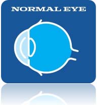 
Affordable Keratoconus Eye Surgery Top Eye Clinics in India