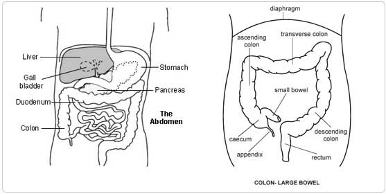 Colectomy Total and Ileostomy surgery india