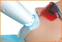 Dental Whitening India